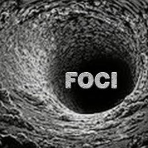 FOCI