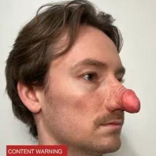 Dihnose 