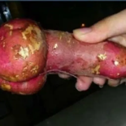 man