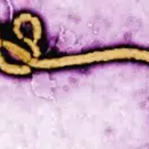 Ebola