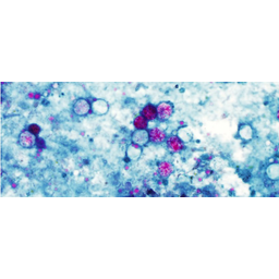 Cyclospora